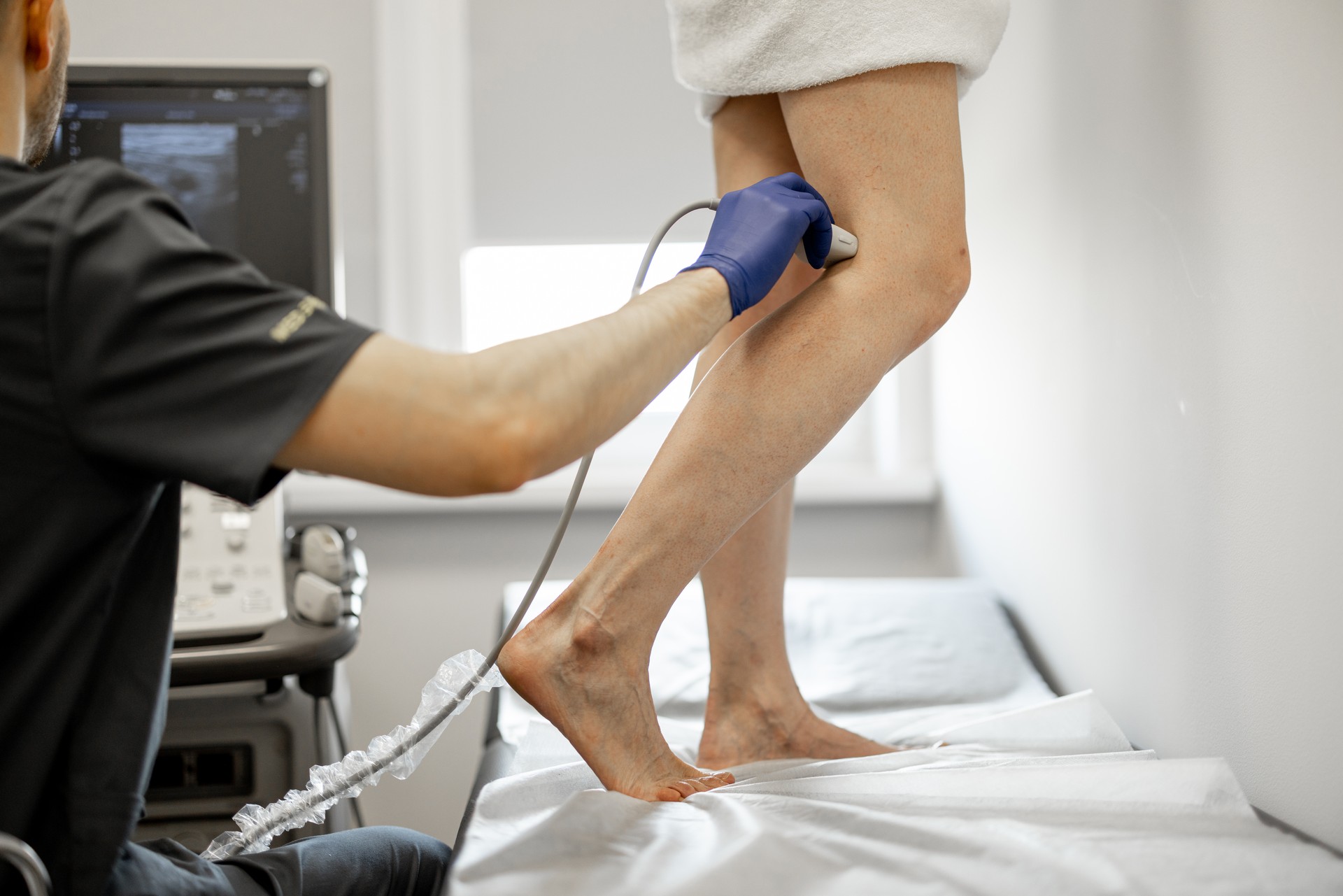 Ultrasound specialist scans veins on a woman's leg